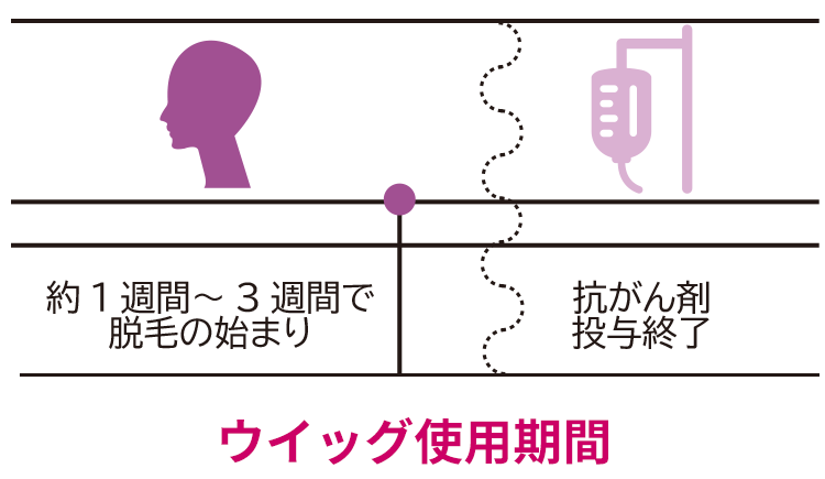 ハイネット 医療ウィッグ治療期間
