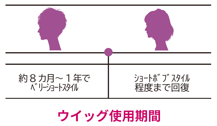 ハイネット 医療ウィッグ治療期間