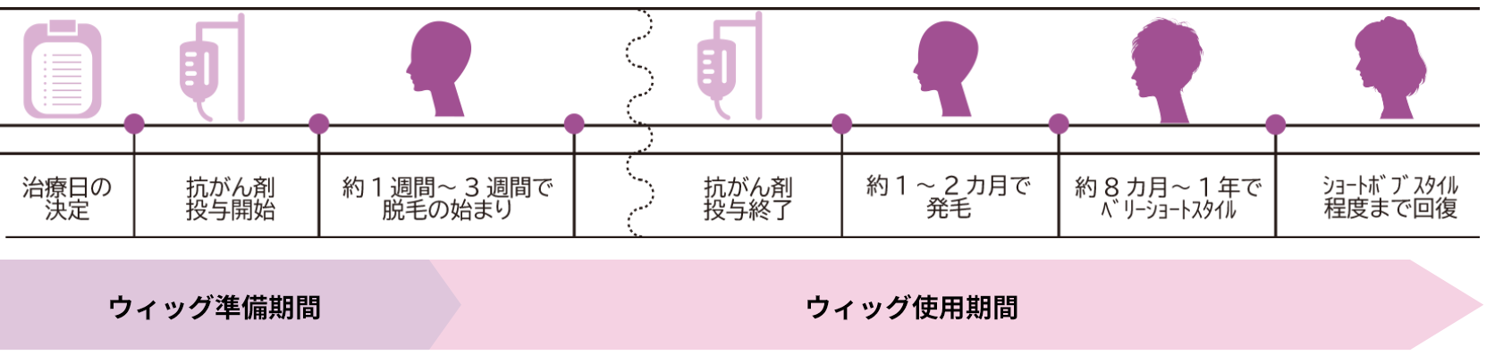 ハイネット 医療ウィッグ治療期間